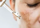 Is it safe to order a tretinoin script from online doctors?